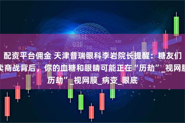配资平台佣金 天津普瑞眼科李岩院长提醒：糖友们注意啦！外卖商战背后，你的血糖和眼睛可能正在“历劫”_视网膜_病变_眼底